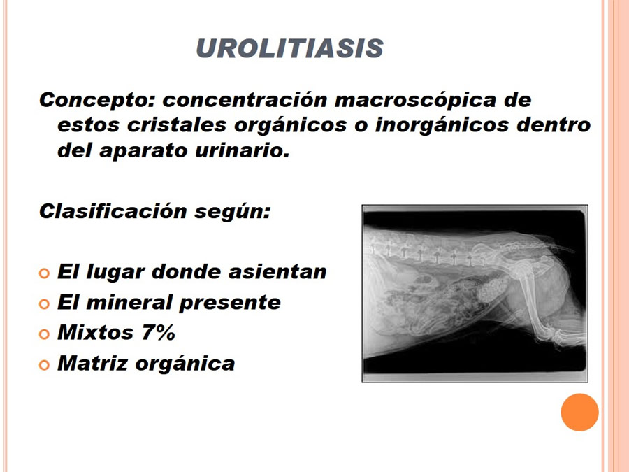 Caso Clnico, Urolitiasis