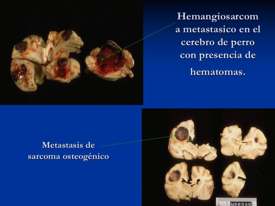 Enfermedades sistmicas