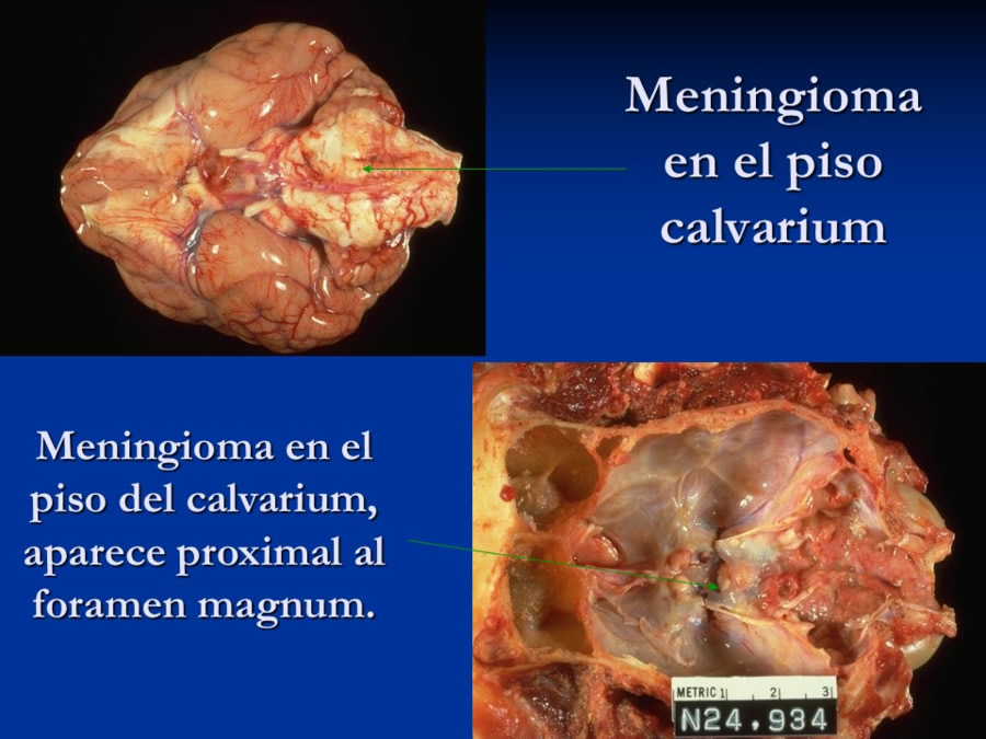 Enfermedades sistmicas