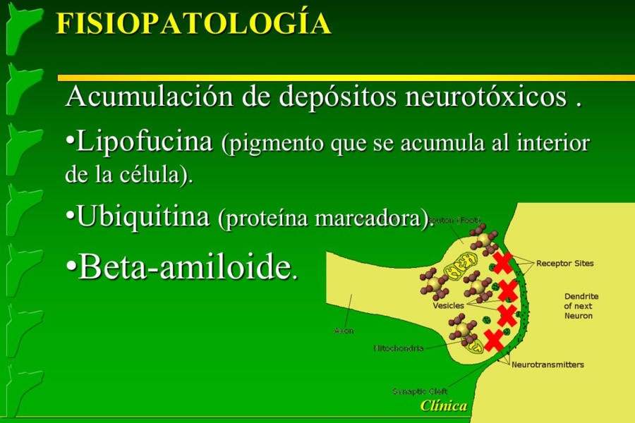 Problemas conductuales en el paciente geritrico