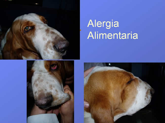 Alergia alimentaria