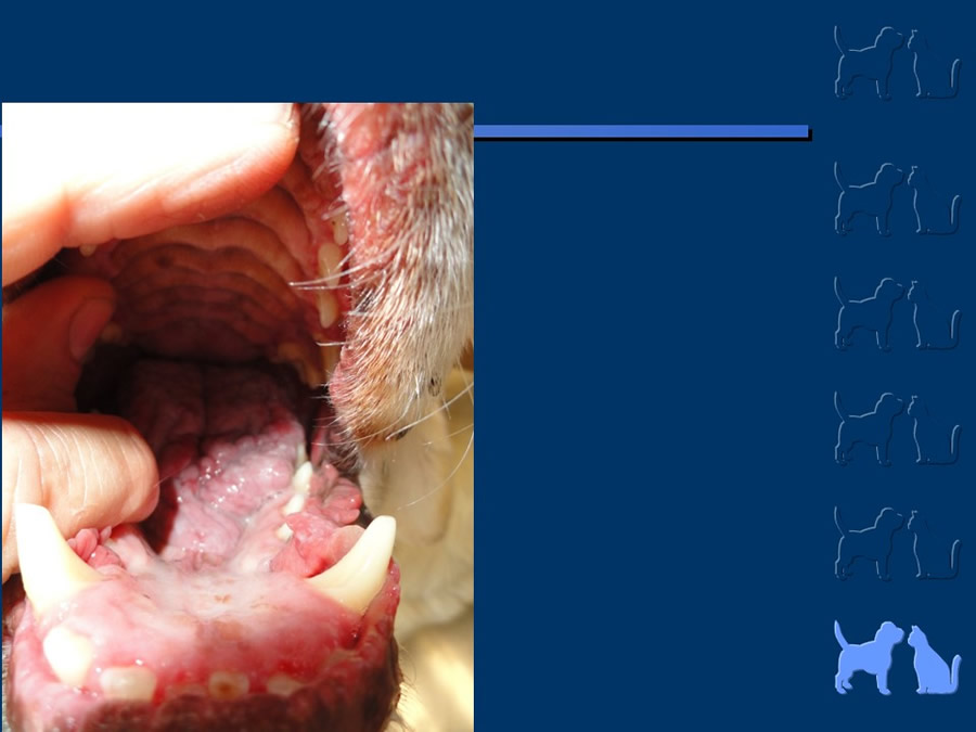 Carcinoma Hepatocelular