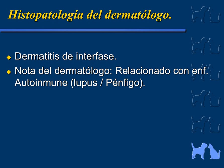 Carcinoma Hepatocelular