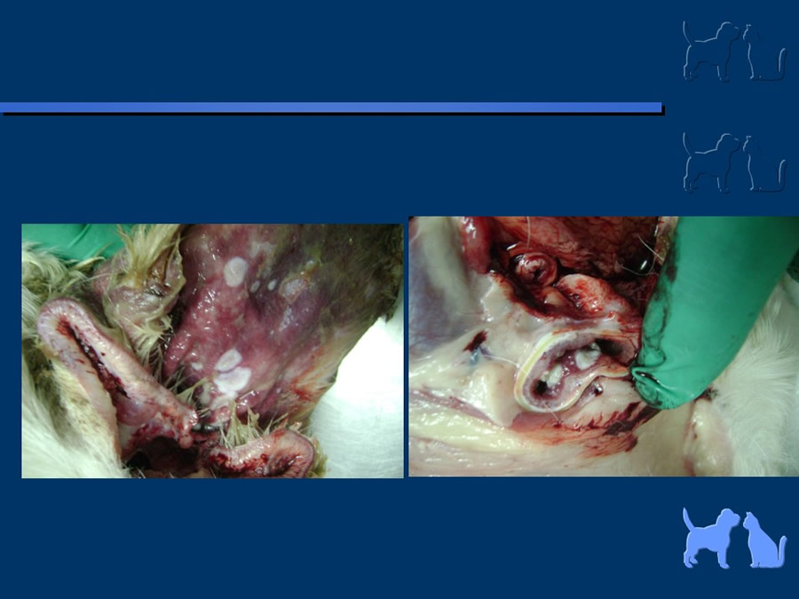 Carcinoma Hepatocelular