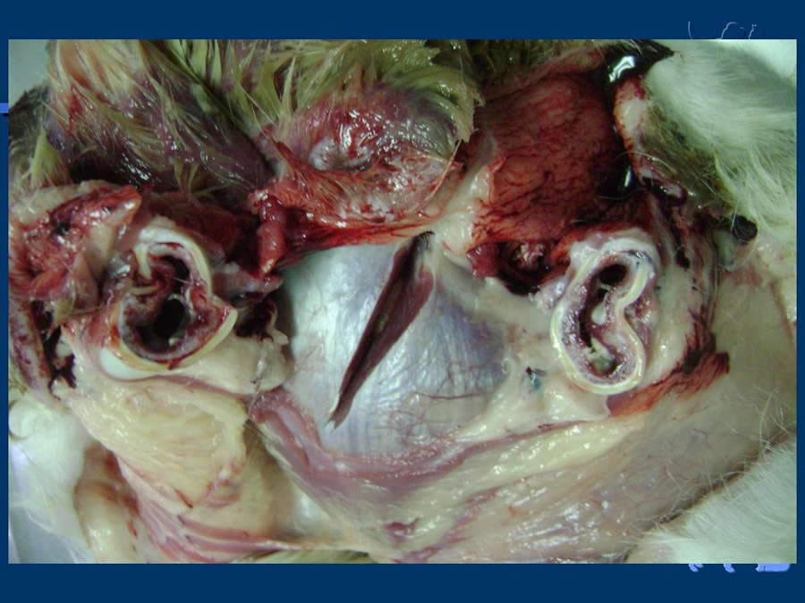 Carcinoma Hepatocelular