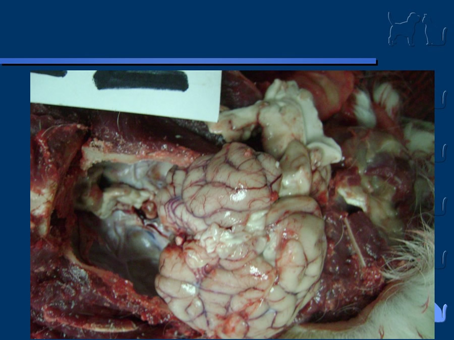 Carcinoma Hepatocelular