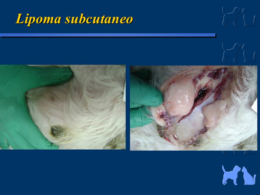 Carcinoma Hepatocelular