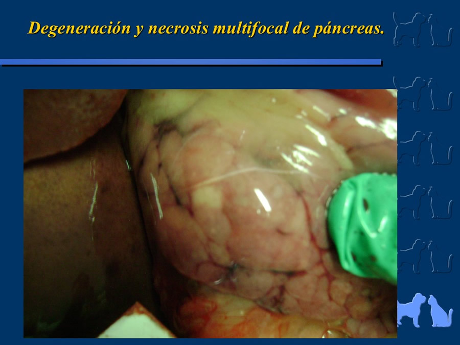 Carcinoma Hepatocelular