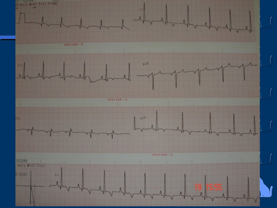 Cardiologa bsica