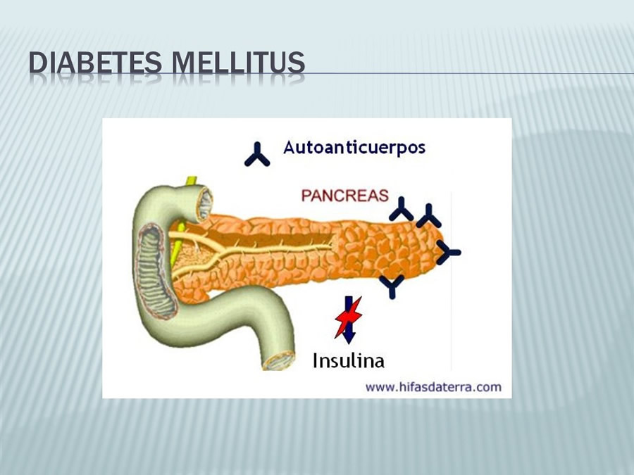 Diabetes Mellitus