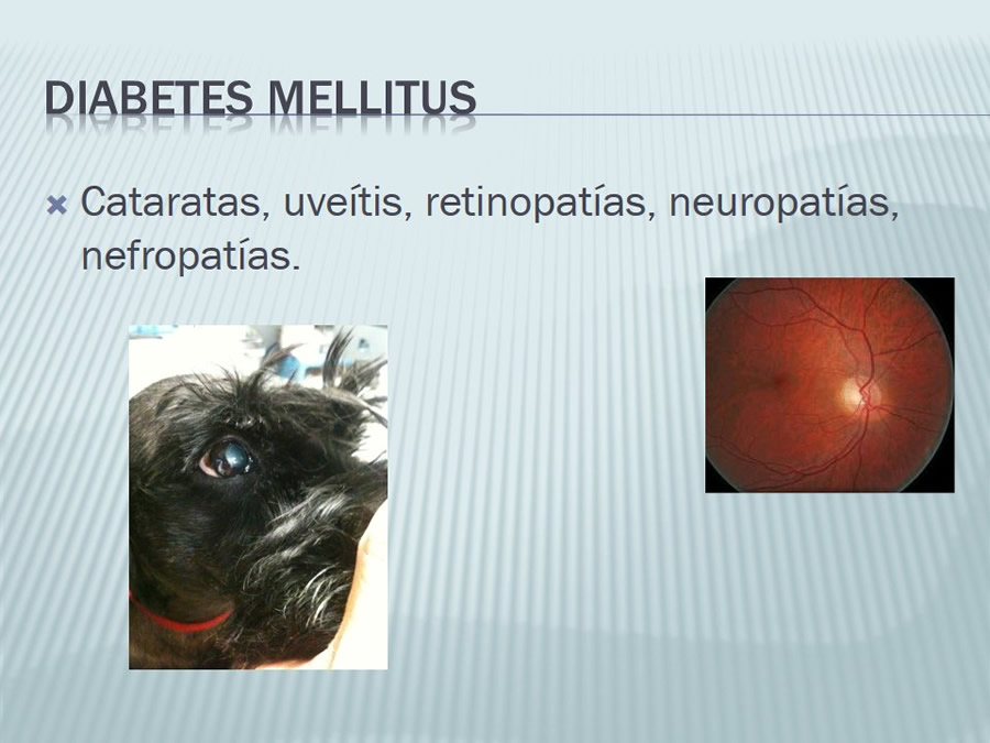 Diabetes Mellitus