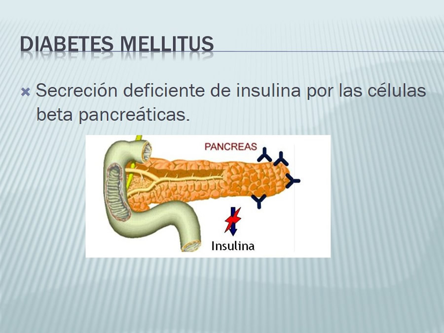 Diabetes Mellitus