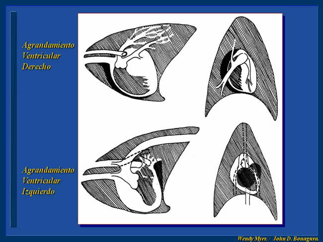 Enfermedad Cardiovascular