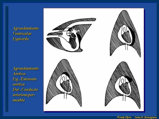 Enfermedad Cardiovascular