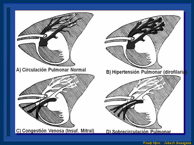 Enfermedad Cardiovascular