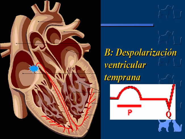 Enfermedad Cardiovascular