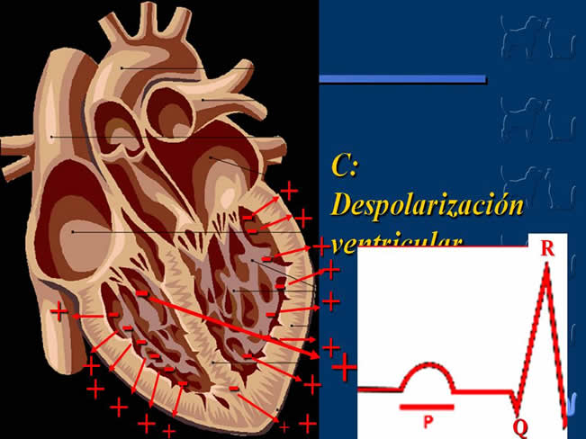 Enfermedad Cardiovascular