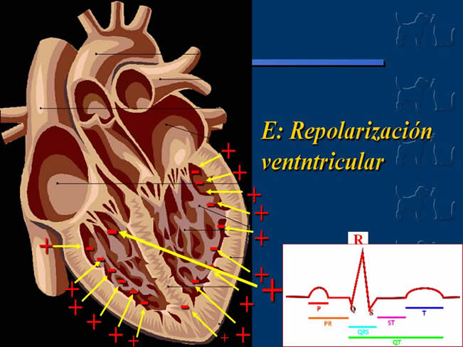 Enfermedad Cardiovascular