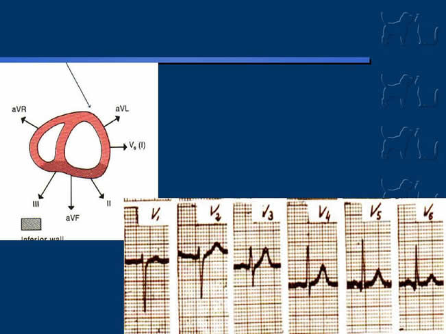 Enfermedad Cardiovascular