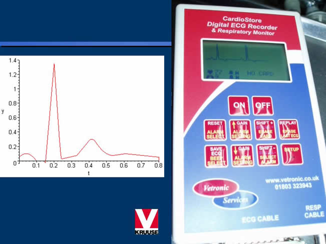 Enfermedad Cardiovascular