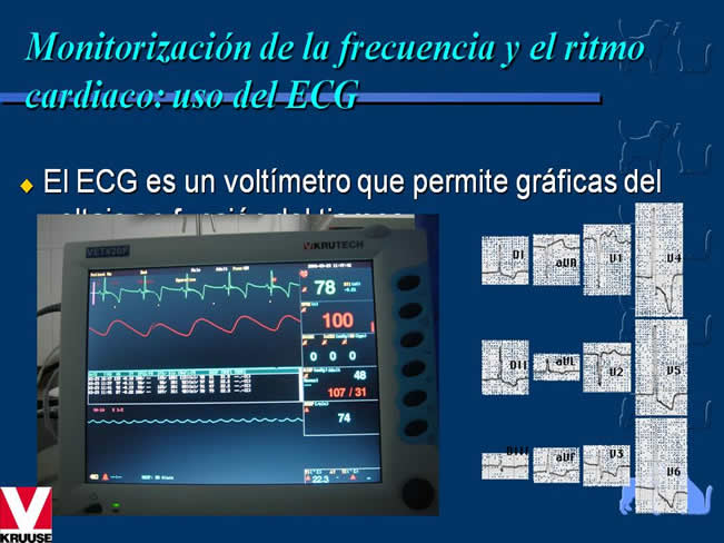 Enfermedad Cardiovascular