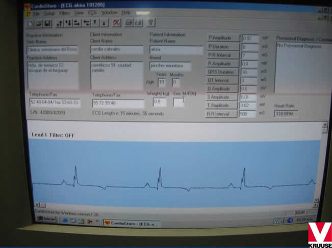 Enfermedad Cardiovascular