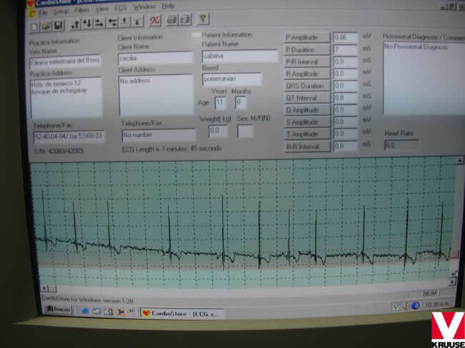 Enfermedad Cardiovascular