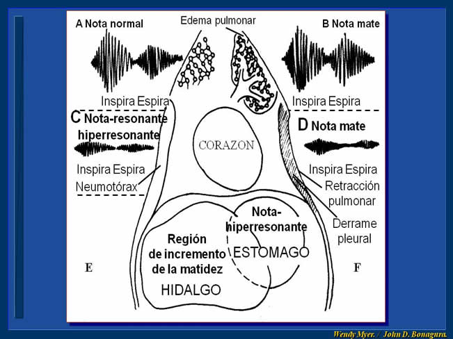 Enfermedad Cardiovascular