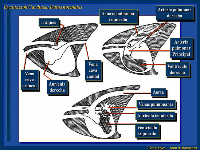 Enfermedad Cardiovascular