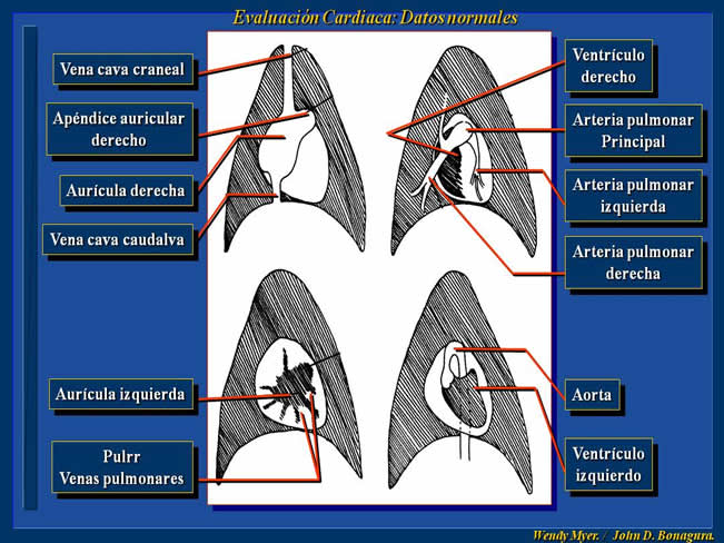 Enfermedad Cardiovascular