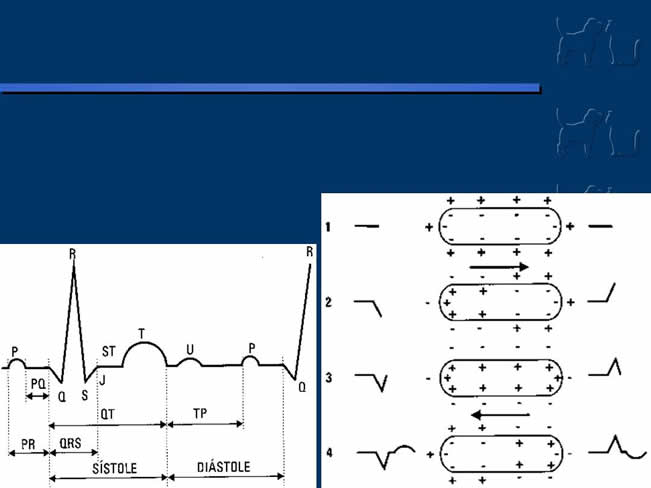 Enfermedad Cardiovascular