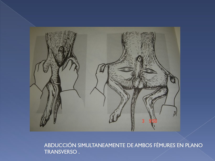 Examen ortopdico