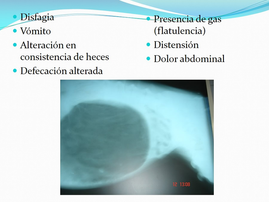 Exploracin del Aparato Digestivo