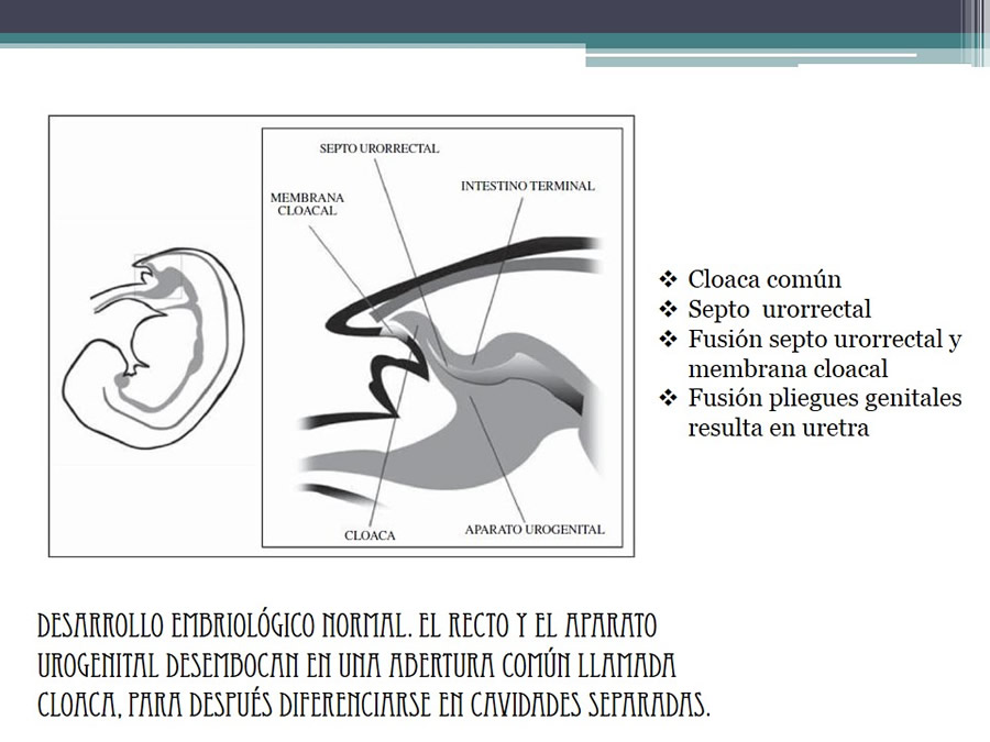 Fstulas Urodigestivas
