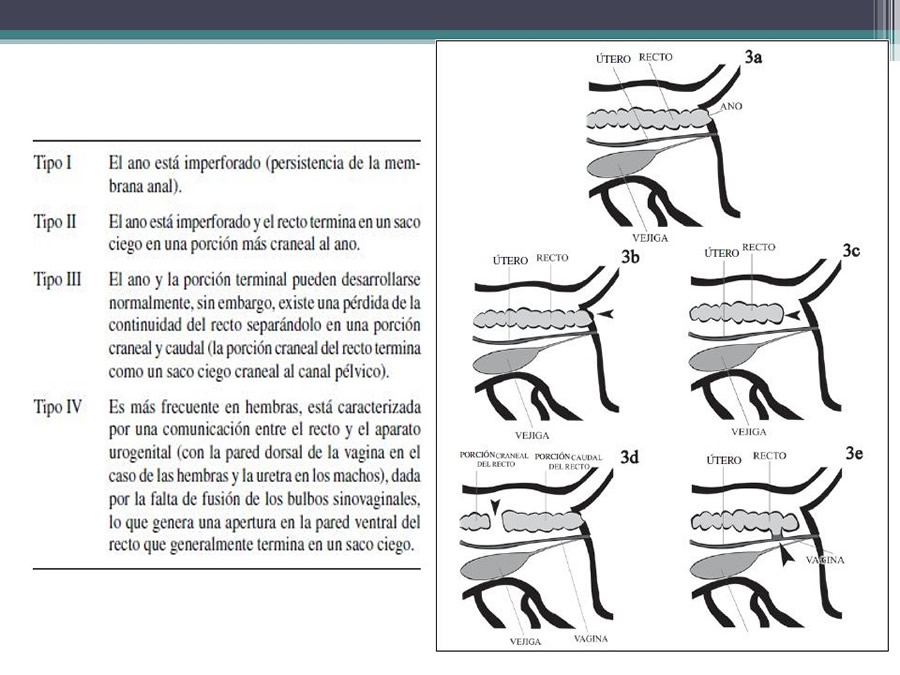 Fstulas Urodigestivas