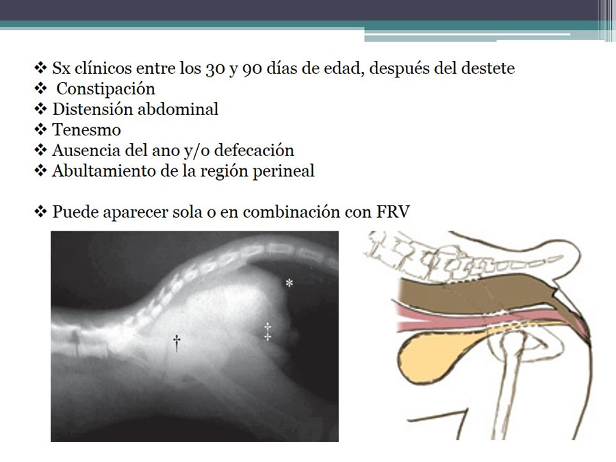 Fstulas Urodigestivas