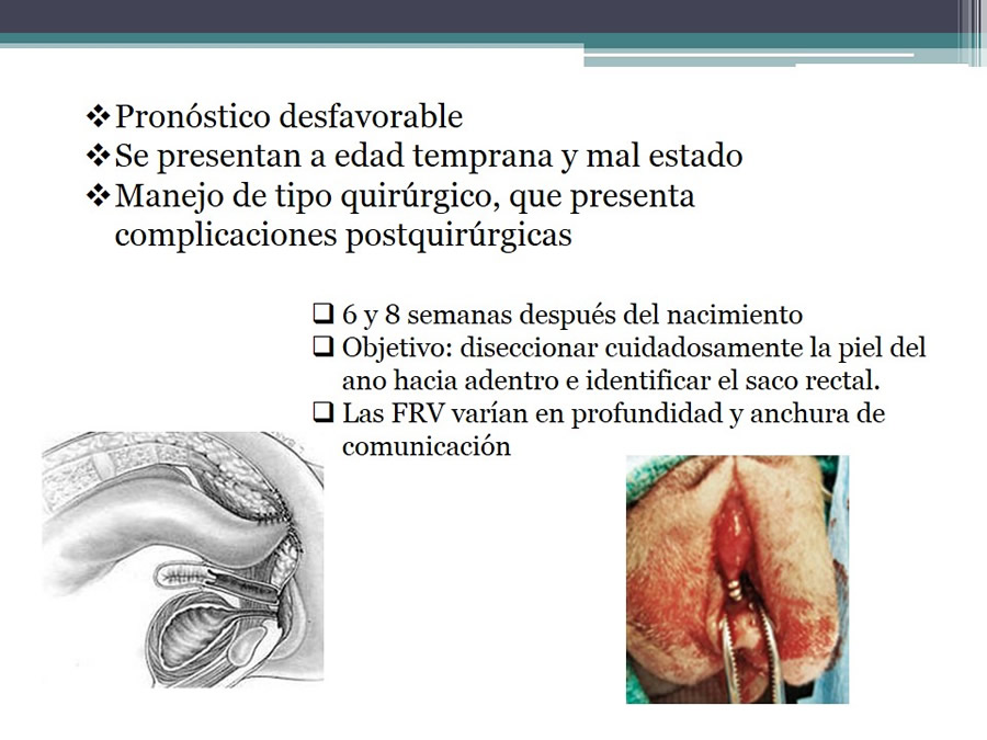 Fstulas Urodigestivas