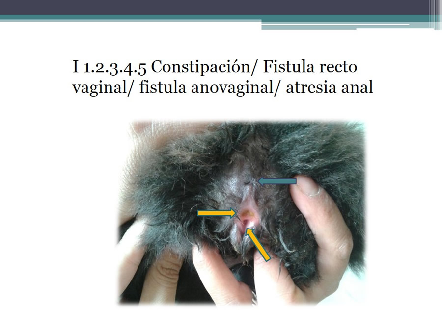 Fstulas Urodigestivas