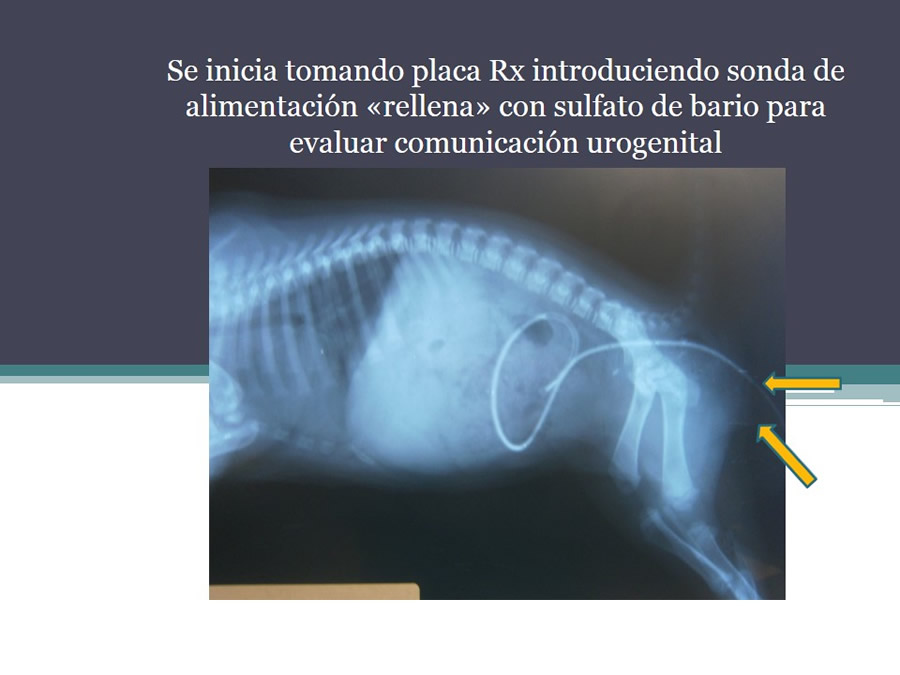Fstulas Urodigestivas