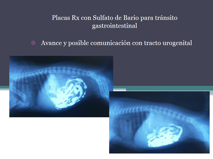 Fstulas Urodigestivas