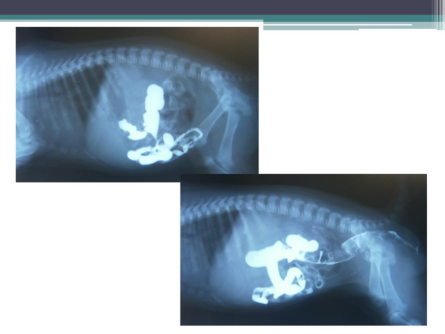 Fstulas Urodigestivas