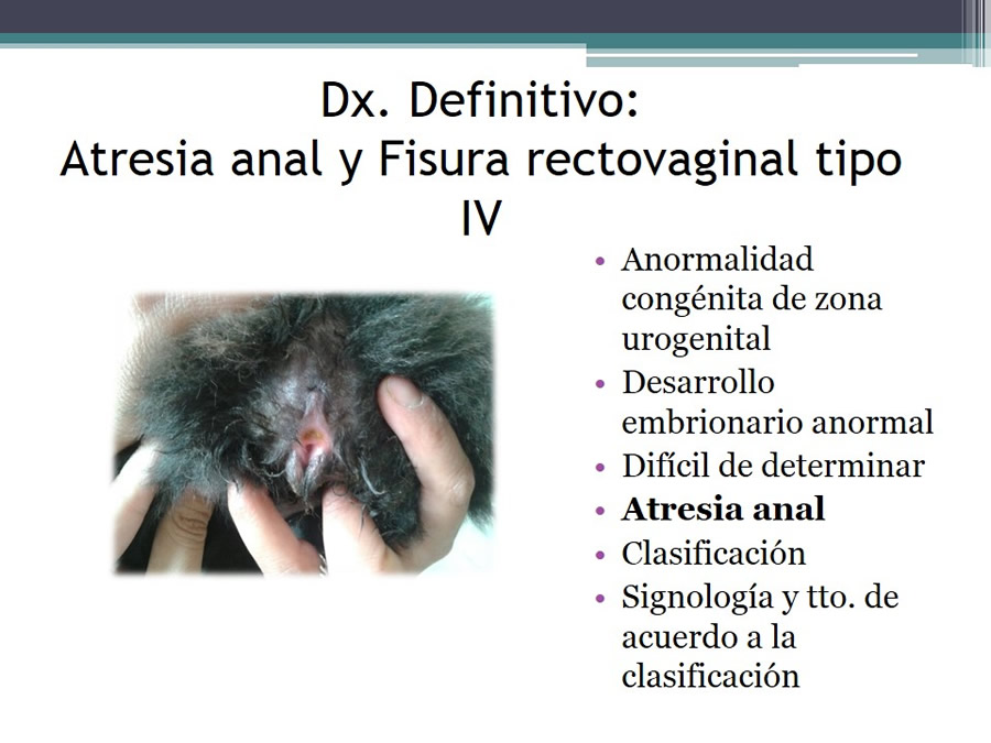 Fstulas Urodigestivas
