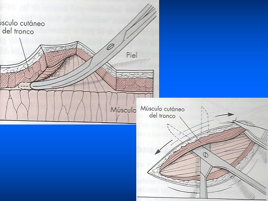 Manejo De Heridas