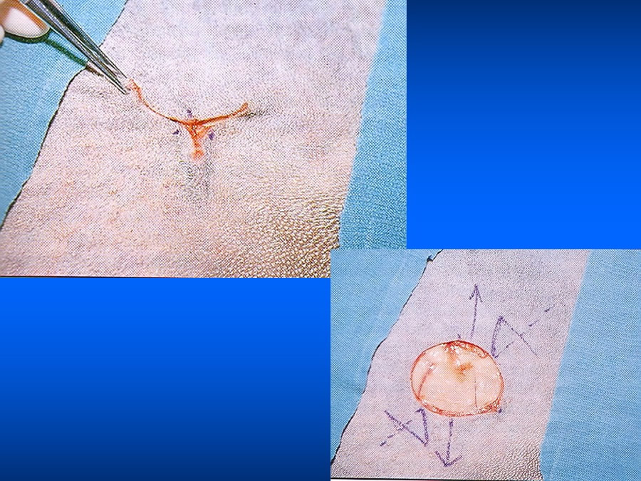 Manejo De Heridas