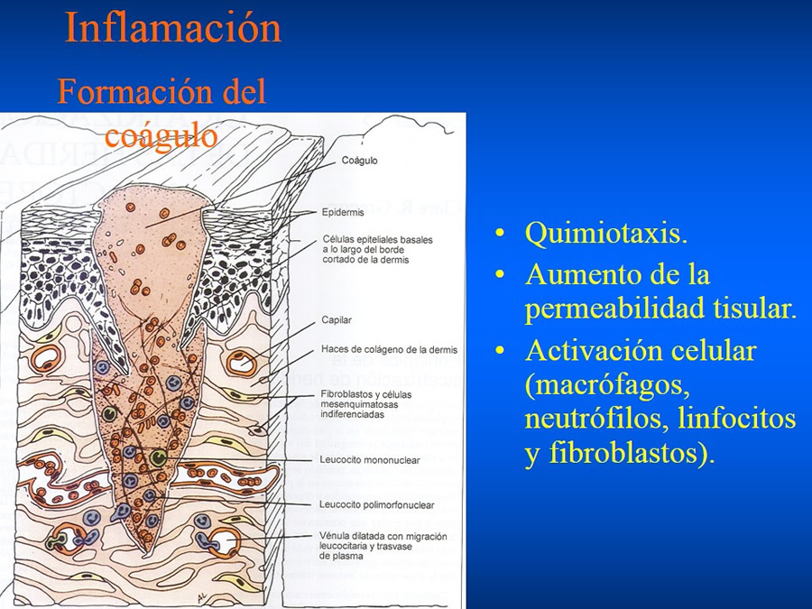 Manejo De Heridas