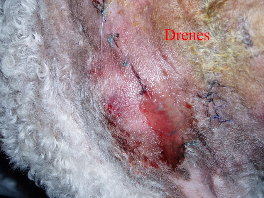 Manejo De Heridas