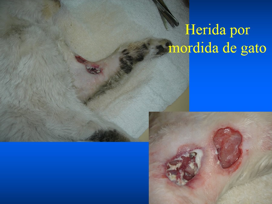 Manejo De Heridas