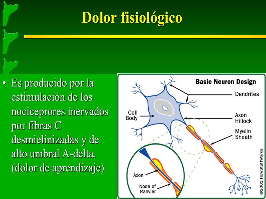 Manejo del Dolor