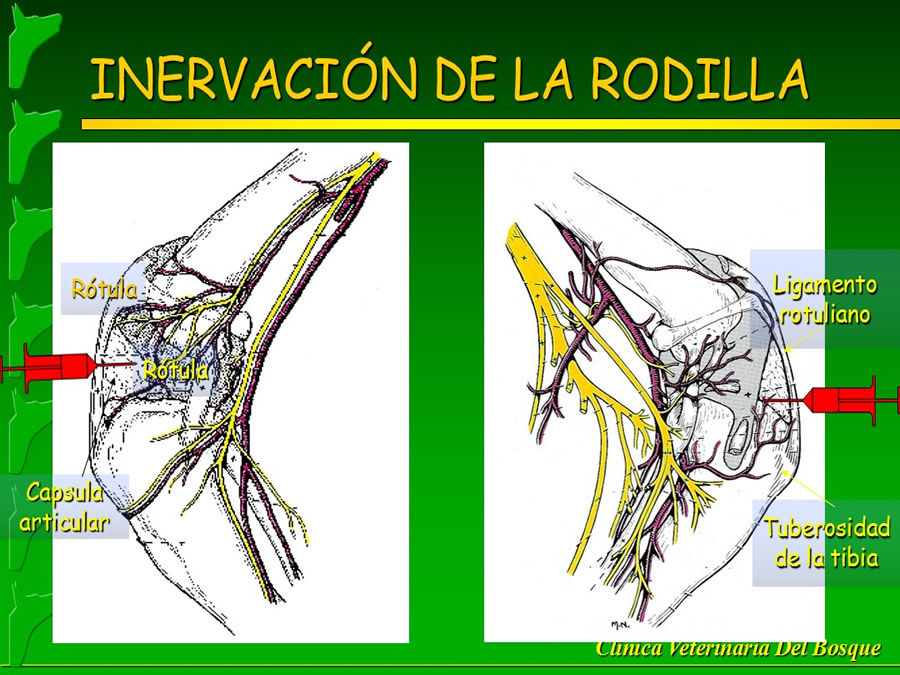 Manejo del Dolor