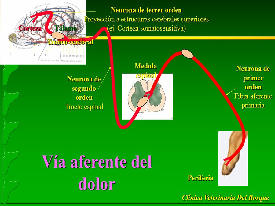 Manejo del Dolor